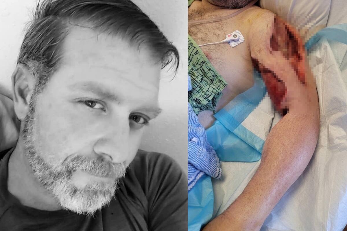 Otro incidente en el film de "Rust": Trabajador podría perder el brazo por estas razones