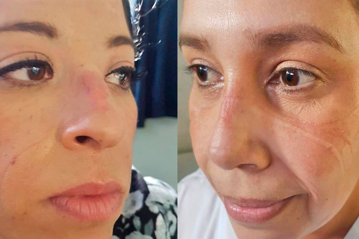 Lucha contra el Covid-19 deja su marca en personal de salud de Tijuana