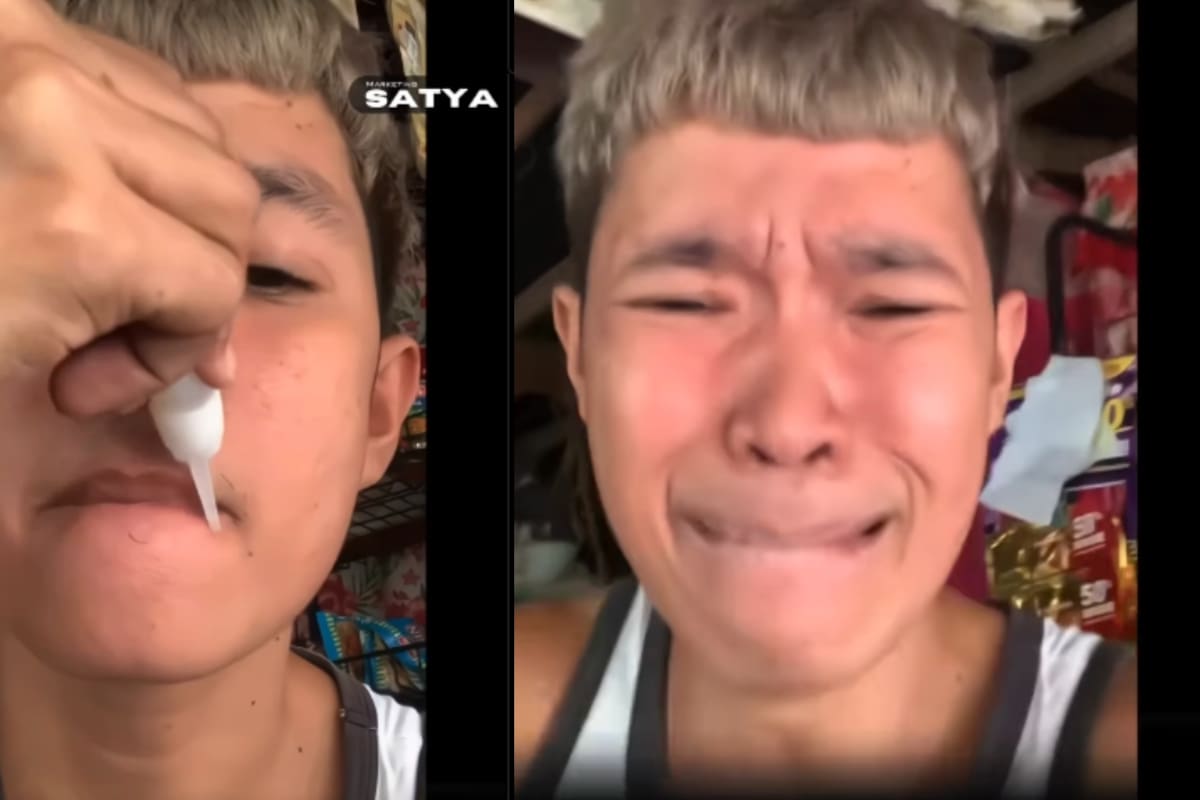 Joven intenta una broma con pegamento en la boca y acaba sellándosela