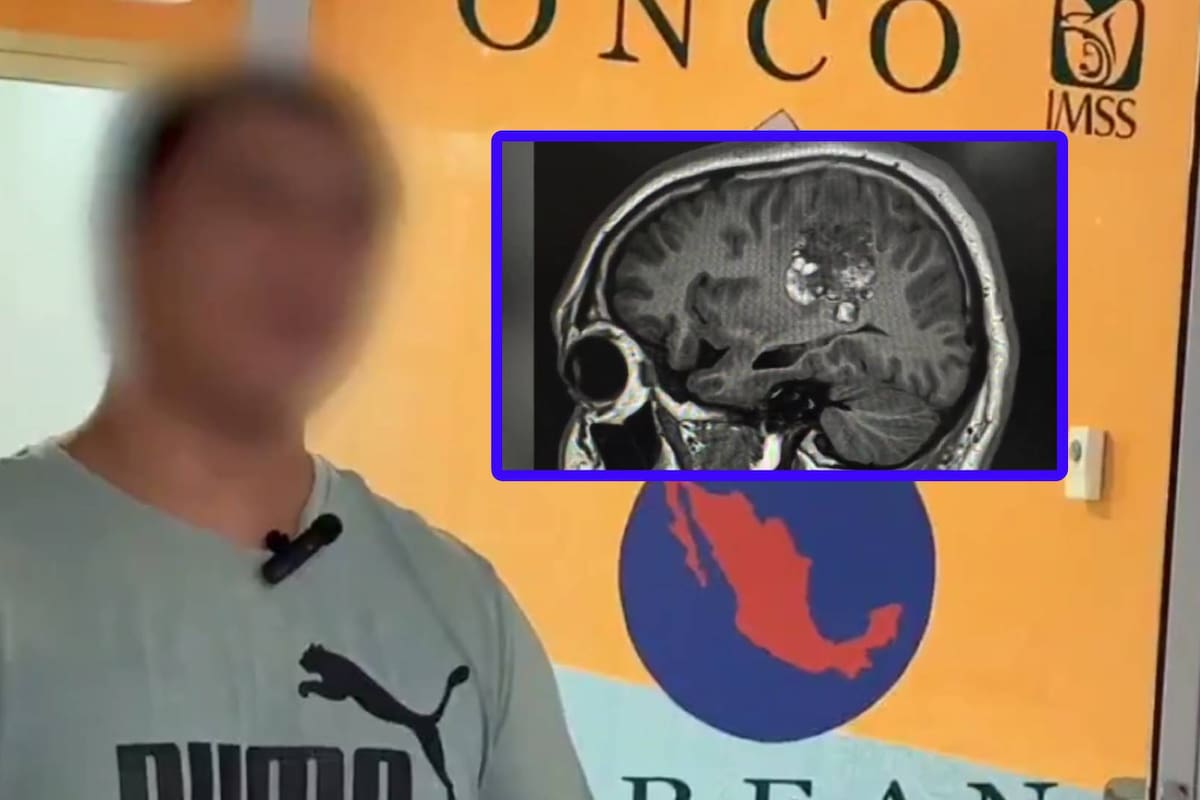 Avance médico en Yucatán: Operan a primer paciente pediátrico despierto durante cirugía cerebral