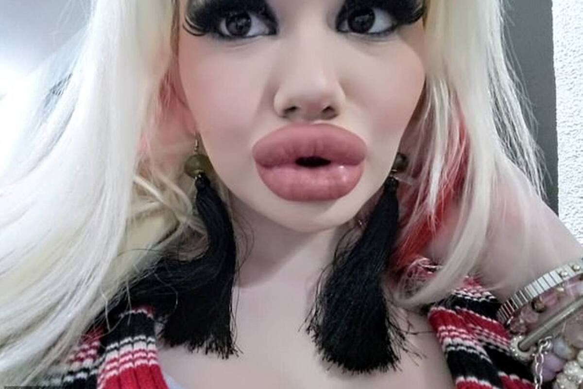 Estudiante sueña con ser la mujer con los labios más grandes del mundo