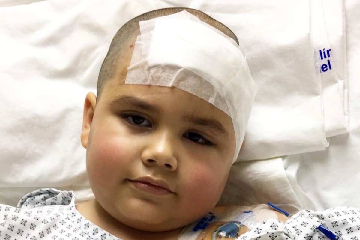 Salones de belleza y fotógrafos se unen para ayudar a Nico, niño que padece tumor en la cabeza