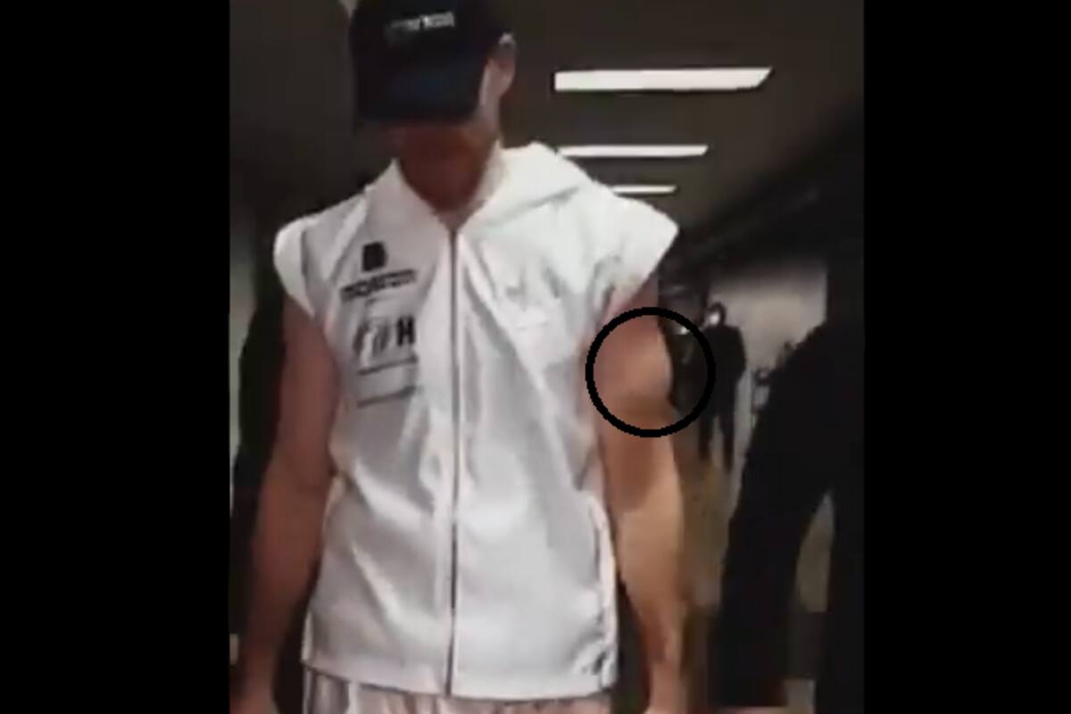 ¿Con biceps desprendido? Rival de "Canelo" Álvarez habría peleado lesionado