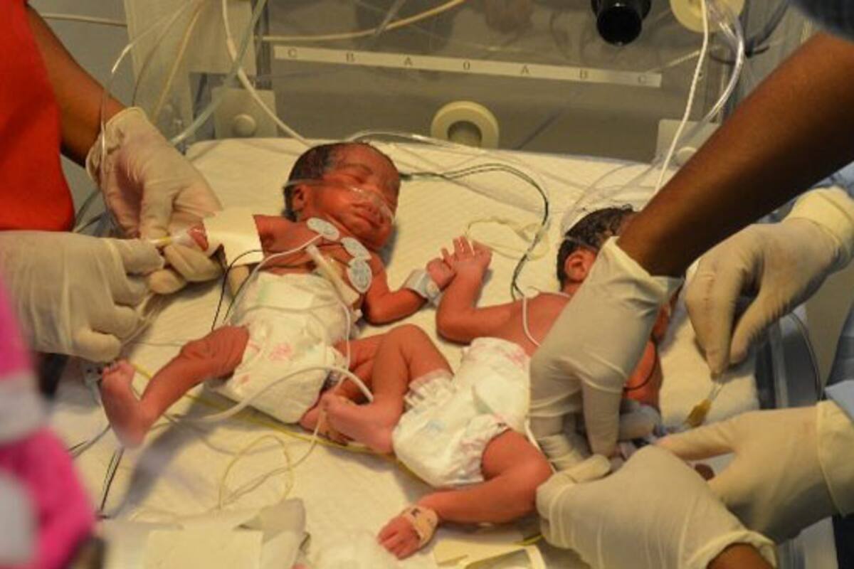 Nacen sextillizos en Polonia: 4 niñas y 2 niños en buena salud