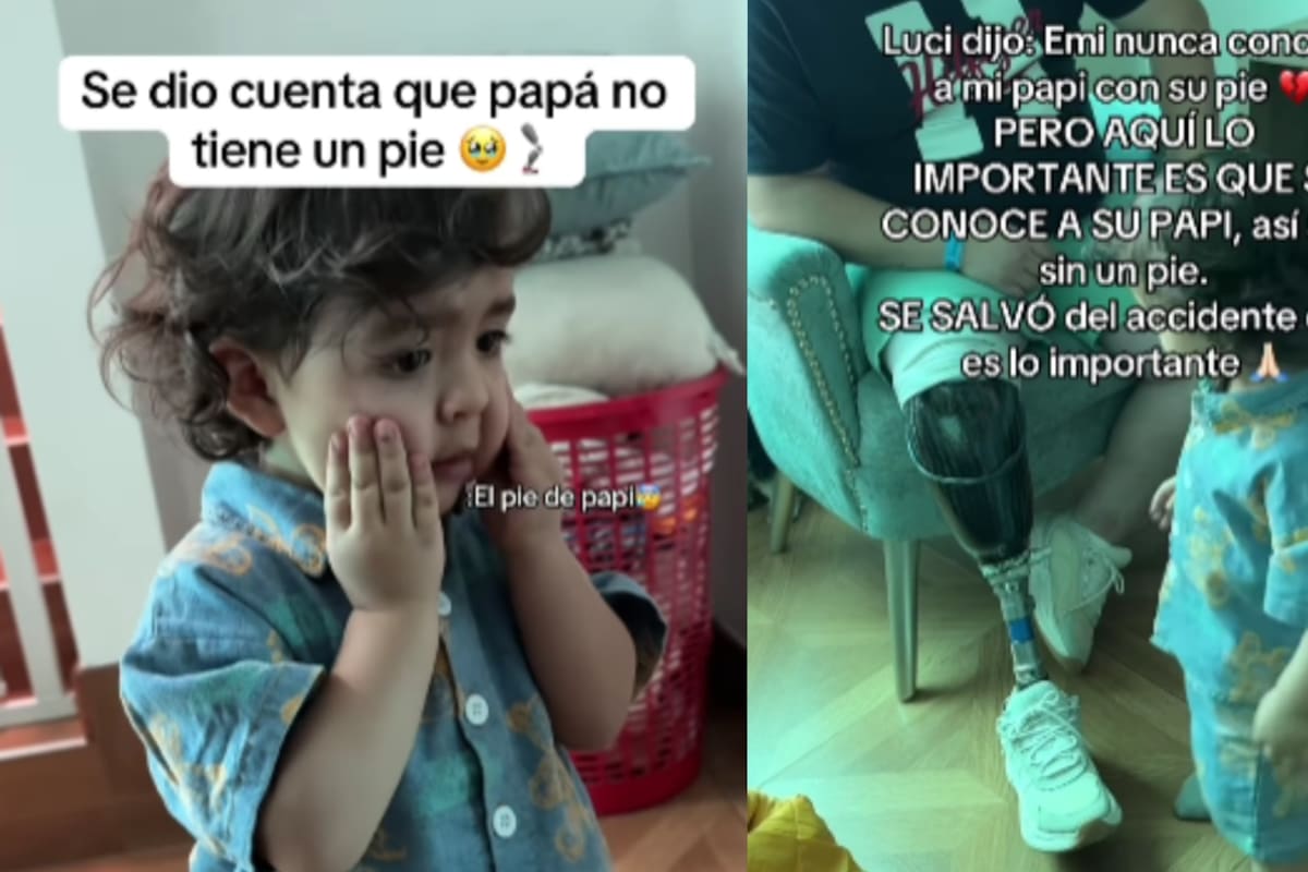 “Se dio cuenta de que papi no tiene un pie”: niño reacciona por primera vez a la pierna protésica de su padre
