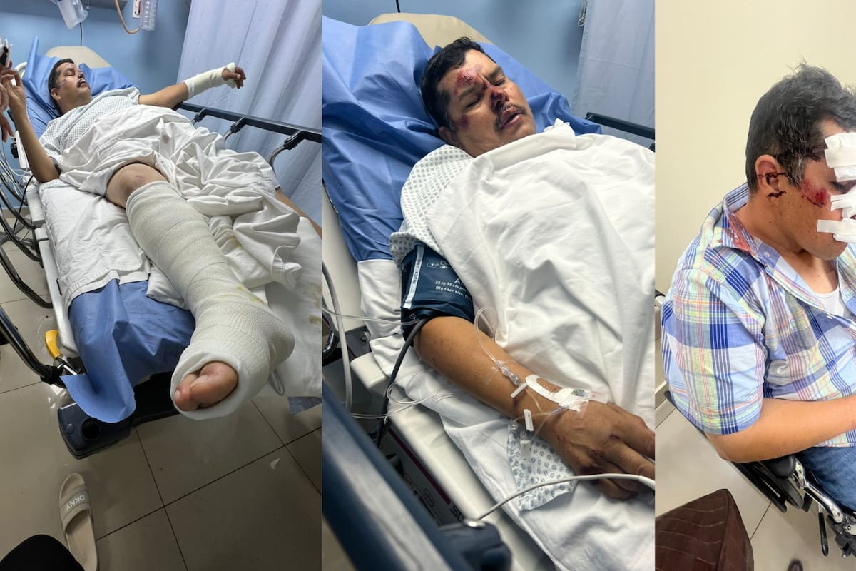 Luis Avilés sufrió fracturas tras agresión de tres hombres en la ExpoGan 2026 y su esposa pidió ayuda para identificarlos