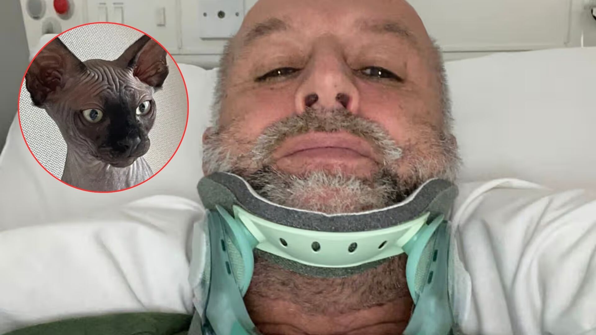 Chris Rowley cayó por 14 escalones tras tropezar con su gato y sufrió múltiples fracturas. (Redes Sociales/Canva)