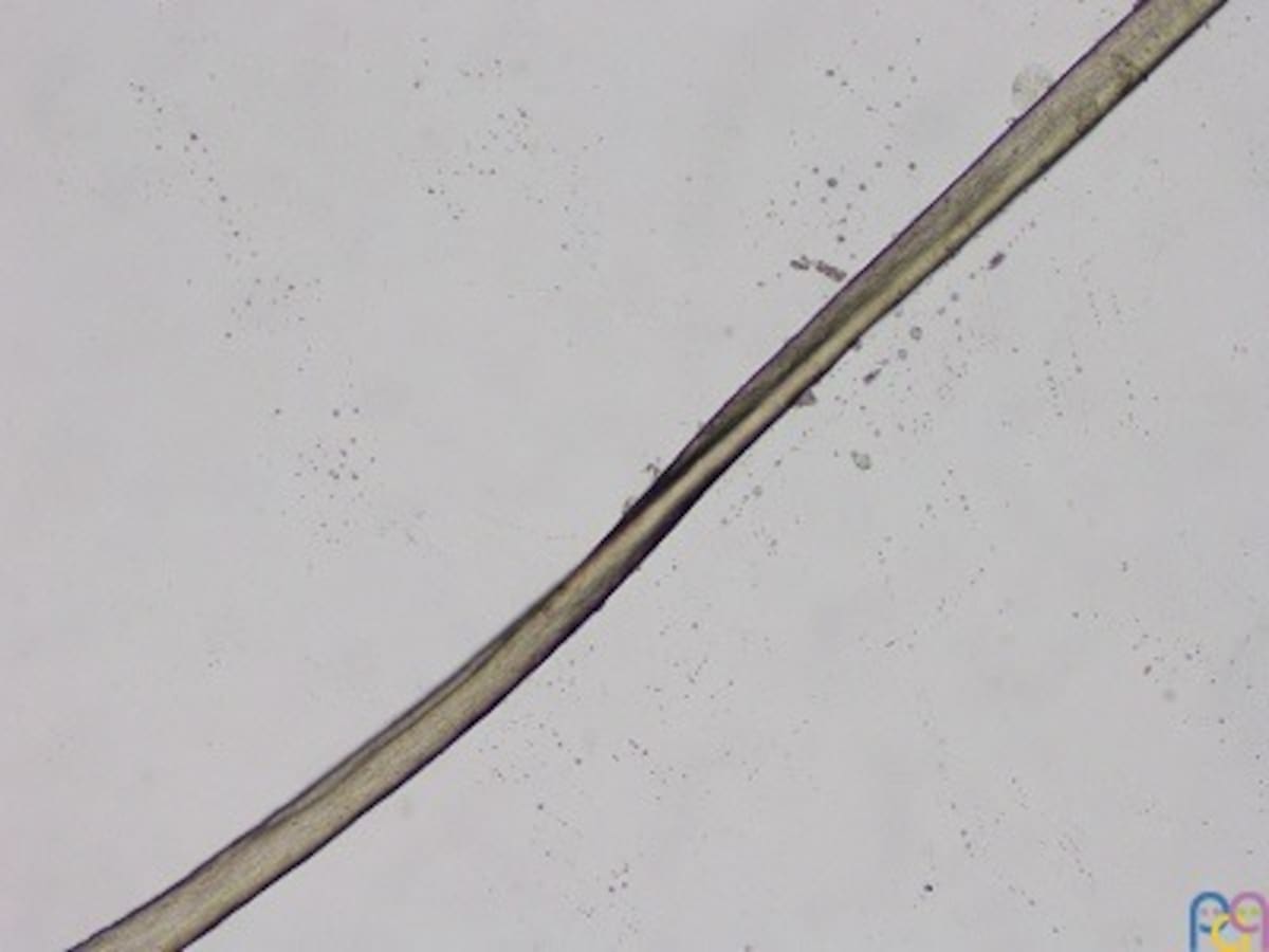 Estudio del pelo mediante microscopía óptica: pili canaliculi.