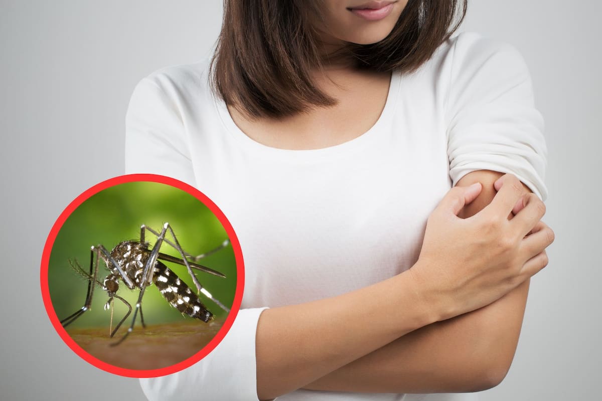 ¿Qué colores de ropa atraen más a los mosquitos?