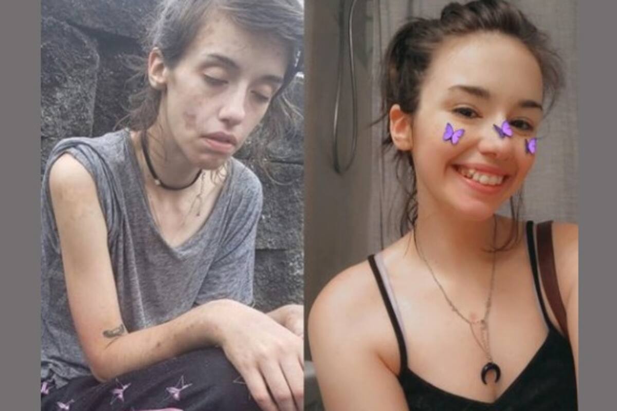 Viral: Joven sorprende al mostrar antes y después de su adicción a drogas