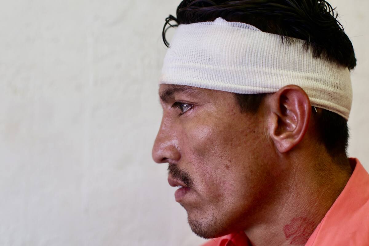 Agreden a personas en el Hotel del Migrante