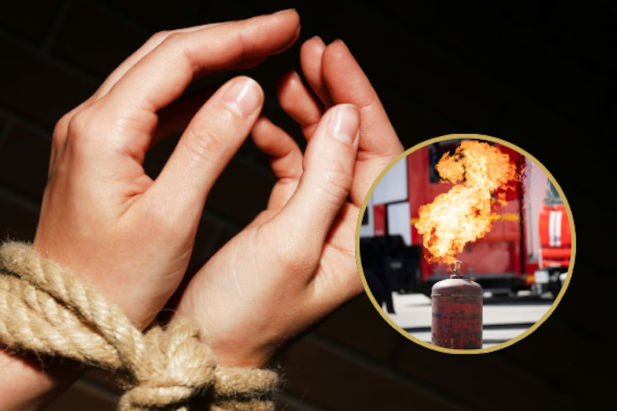 Le prendieron fuego en un escape room y quedó con el 40% del cuerpo quemado:
