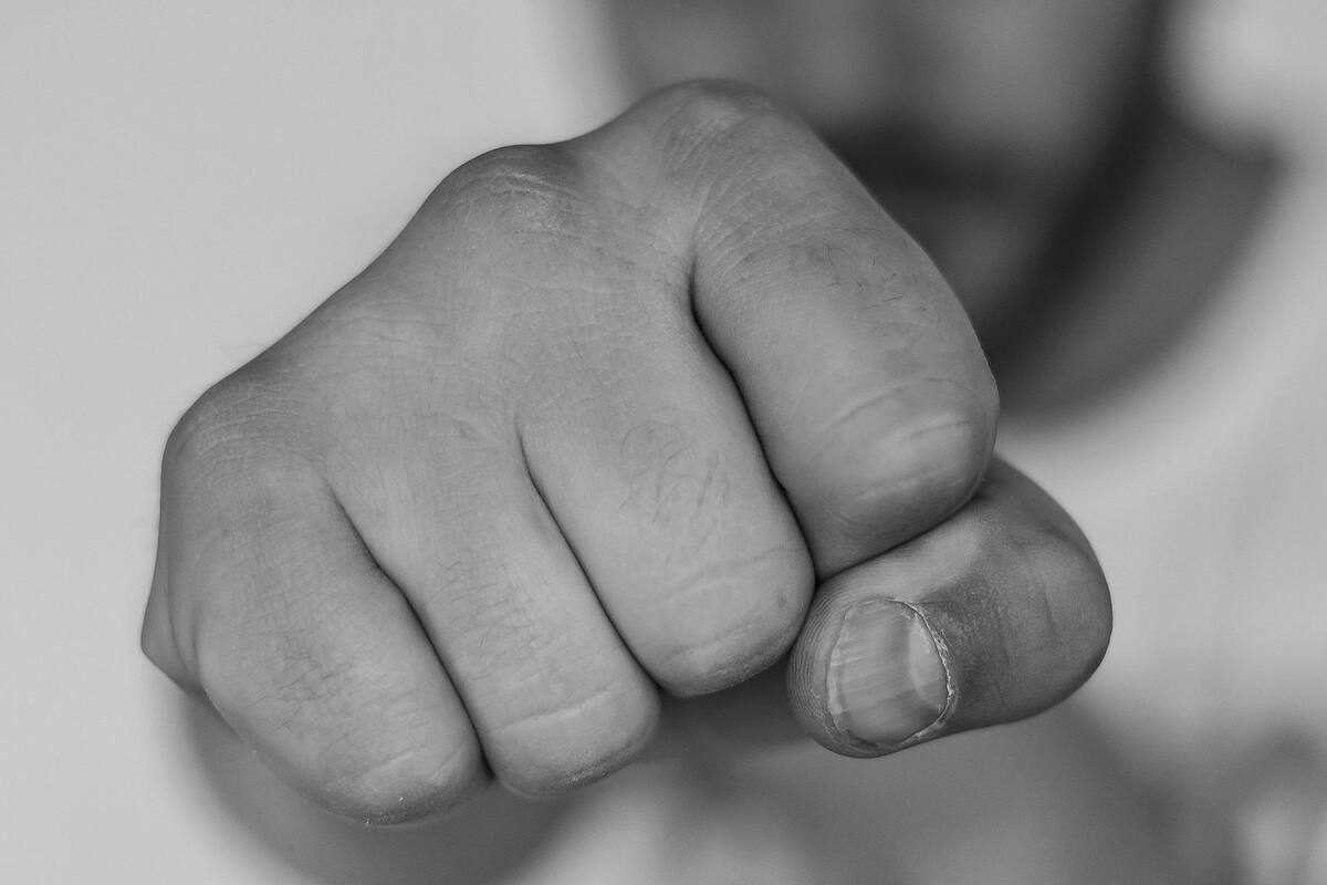 Hombre es golpeado durante asalto en colonia Villa Mercedes; presuntos responsables se dan a la fuga