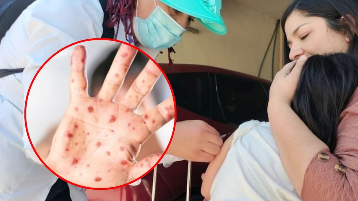 Estados Unidos registra un repunte histórico de sarampión y pone en riesgo su estatus de eliminación: 588 casos van durante enero