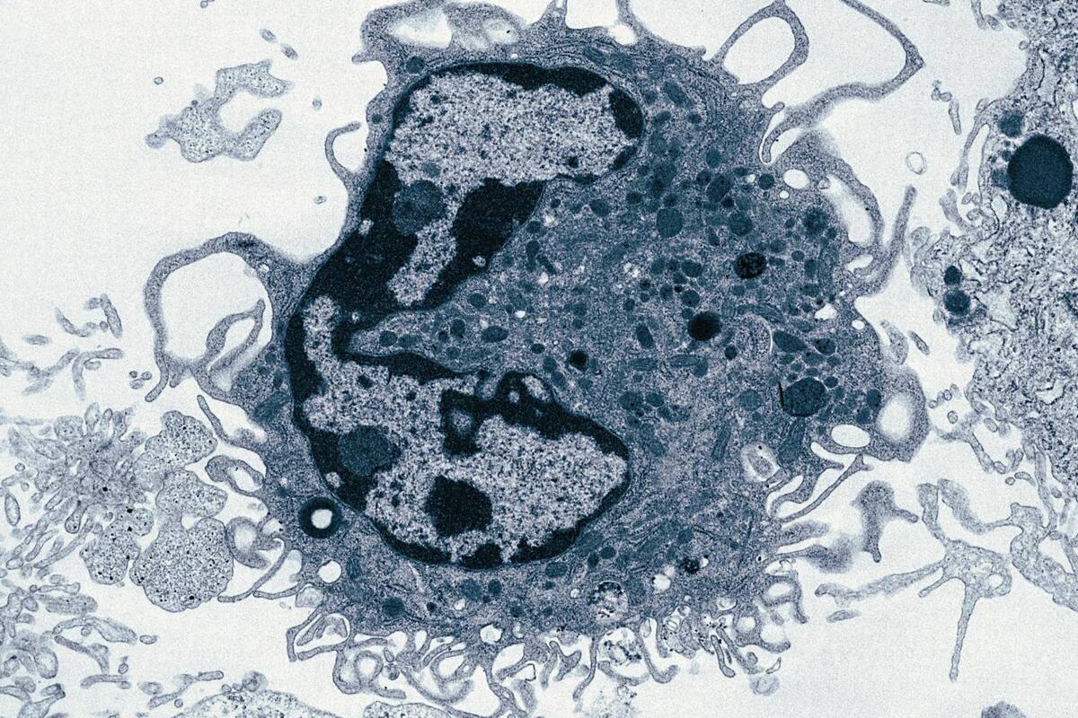 Encuentran una nueva población de células inmunitarias que ayuda a la reparación pulmonar