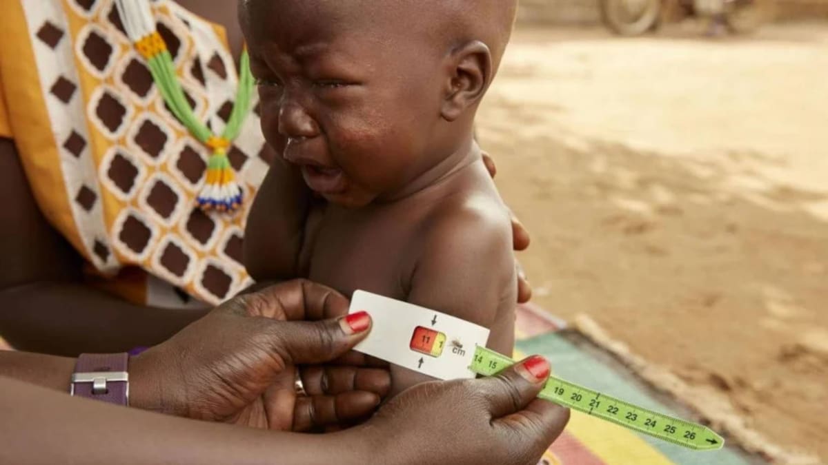 ONU exige medidas urgentes ante desnutrición infantil en Sudán / Foto: UNICEF