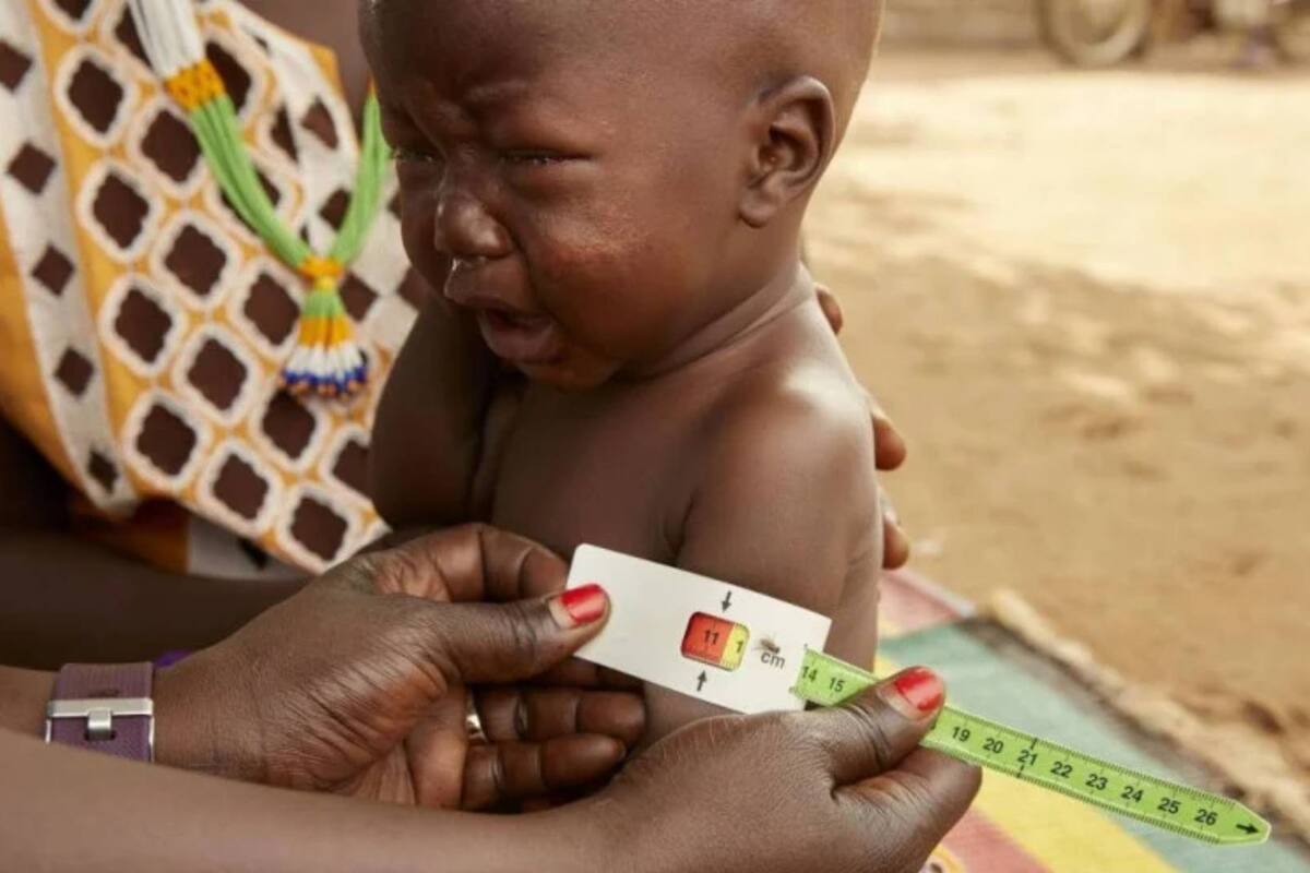 ONU exige medidas urgentes ante desnutrición infantil en Sudán