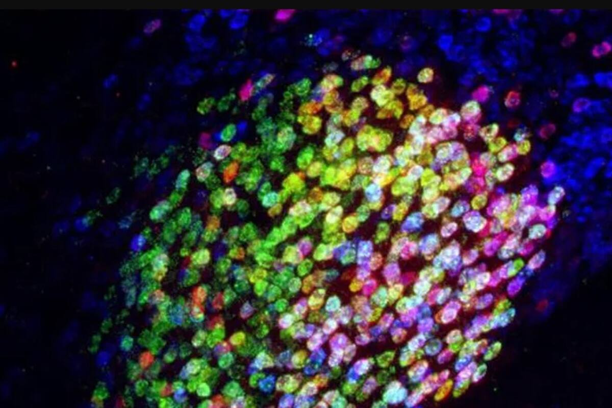 Descubren región del cerebro que apaga completamente el dolor en ratones