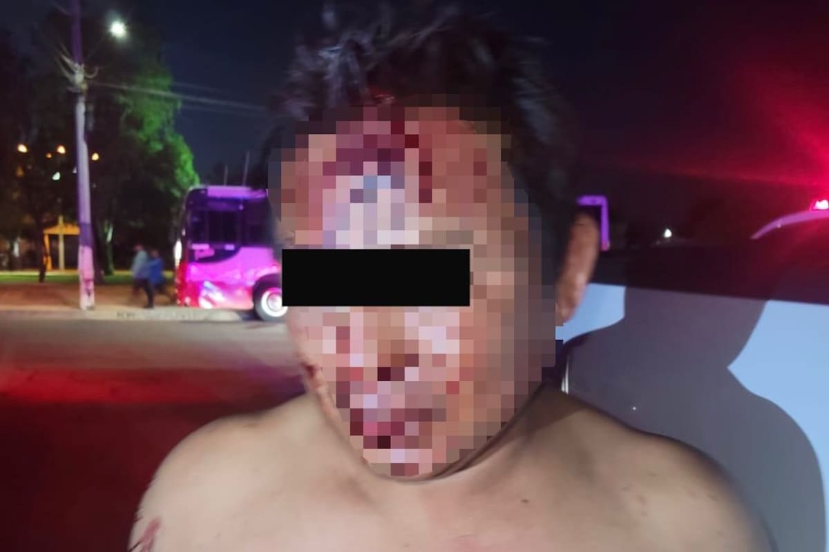 Golpea a su pareja y vecino lo deja severamente lesionado al defenderla