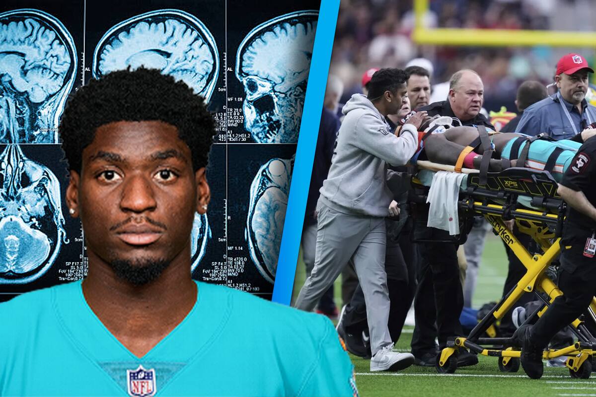 Grant DuBose terminó hospitalizado tras sufrir violenta conmoción cerebral en el Dolphins vs Texans