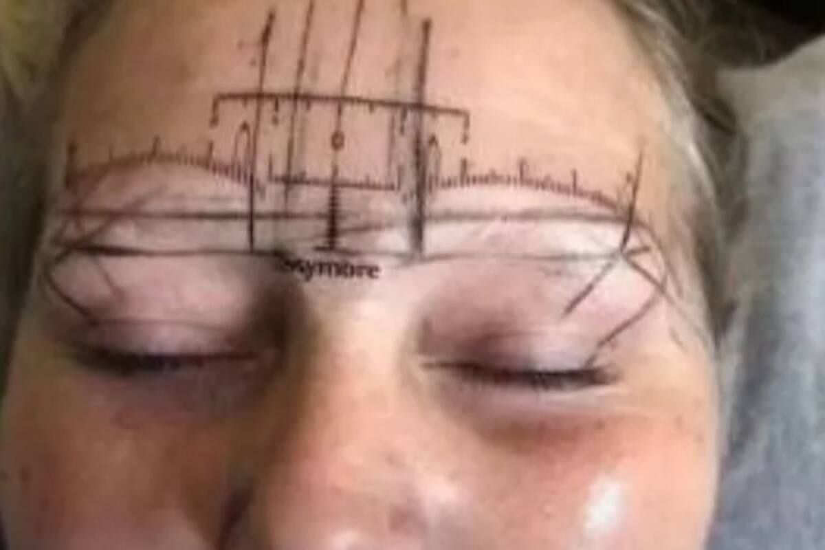 Microblading sale mal, mujer termina con ampollas en las cejas