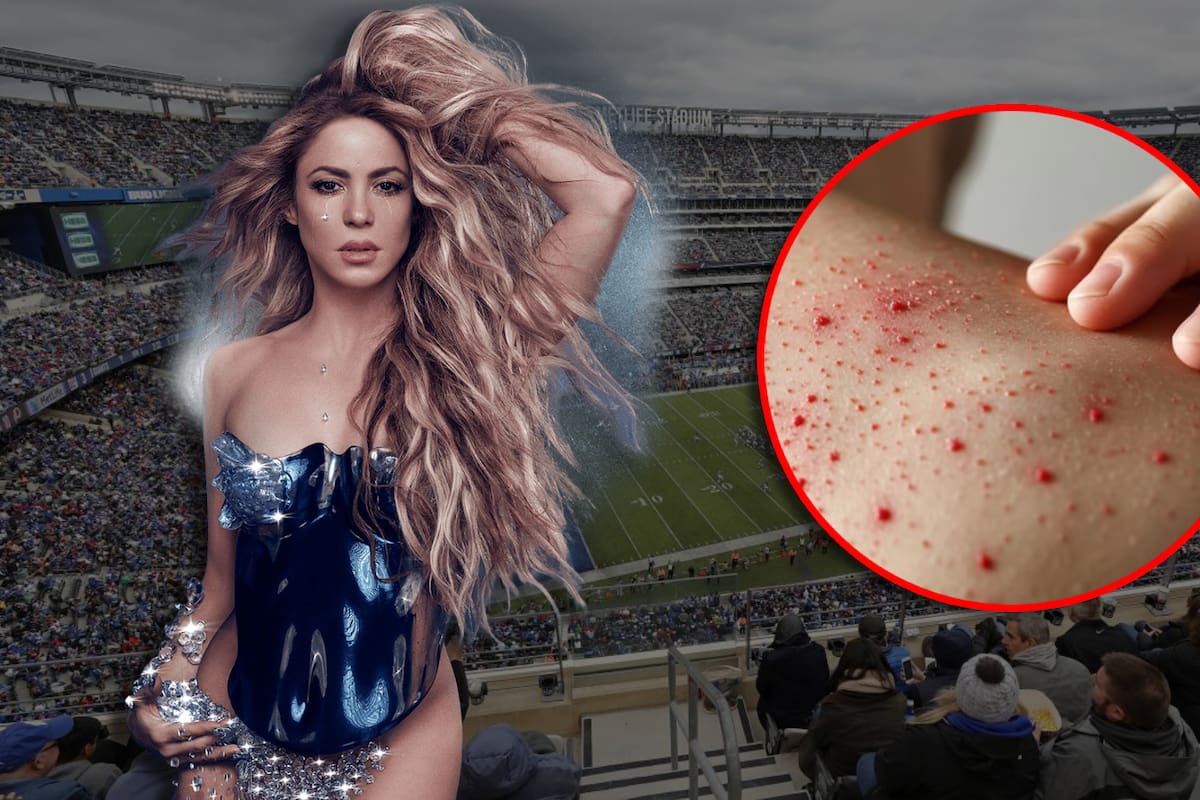 Concierto de Shakira es investigado como posible punto de exposición masiva al sarampión en Nueva Jersey