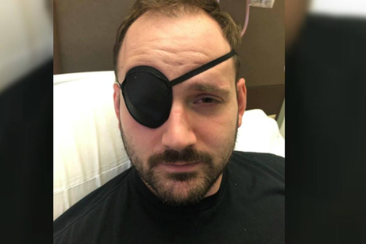 Sufre un derrame cerebral por estirar el cuello