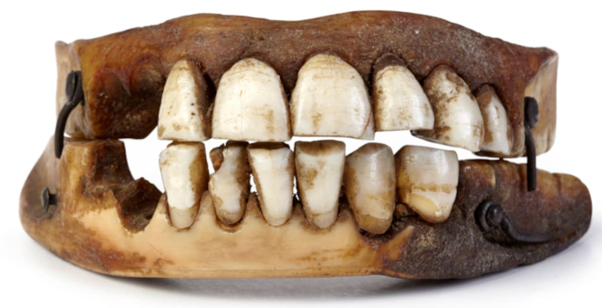 Los dientes de Waterloo.