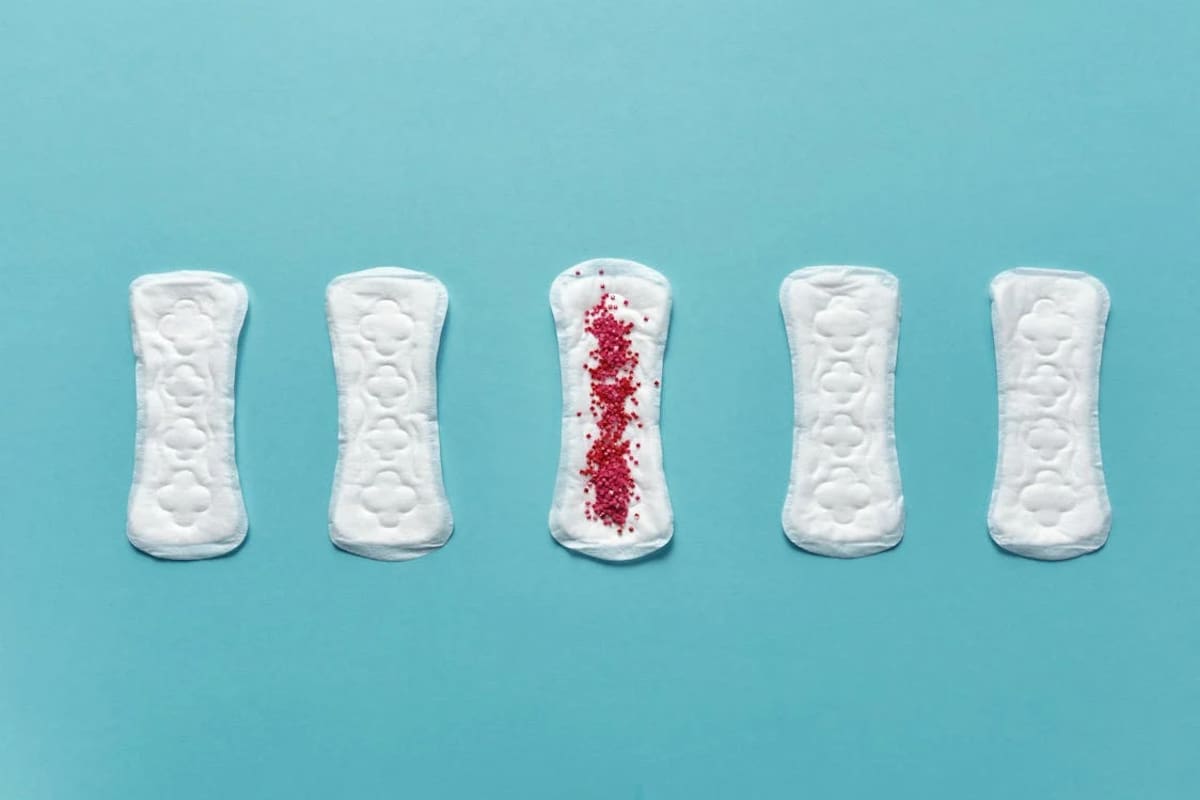 El síndrome premenstrual: Signos y Síntomas