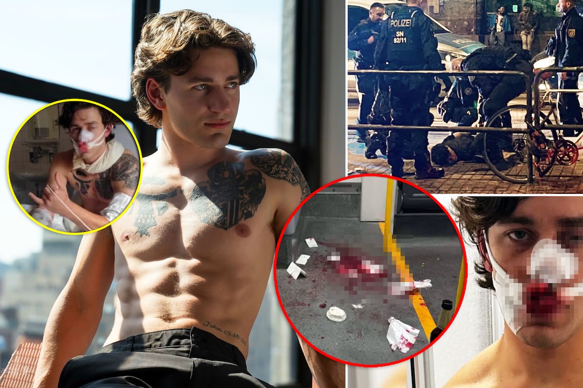 Modelo es brutalmente apuñalado por defender a dos mujeres que estaban siendo “atacadas brutalmente” en un tren alemán; quedará con una cicatriz en el rostro