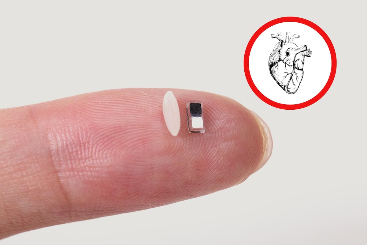 El marcapasos más pequeño del mundo tiene el tamaño de un grano de arroz