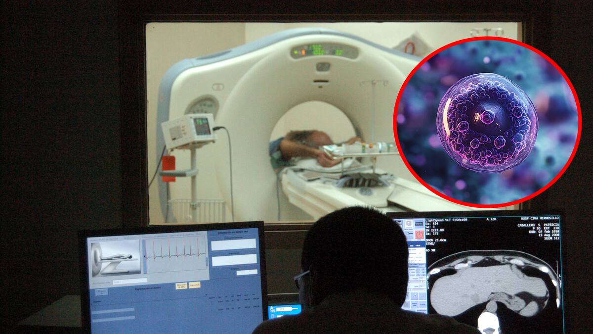 ¿Podrían las tomografías computarizadas estar impulsando un aumento futuro de casos de cáncer, como sugiere un nuevo estudio?