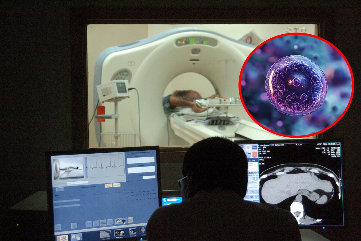 ¿Podrían las tomografías computarizadas estar impulsando un aumento futuro de casos de cáncer, como sugiere un nuevo estudio?