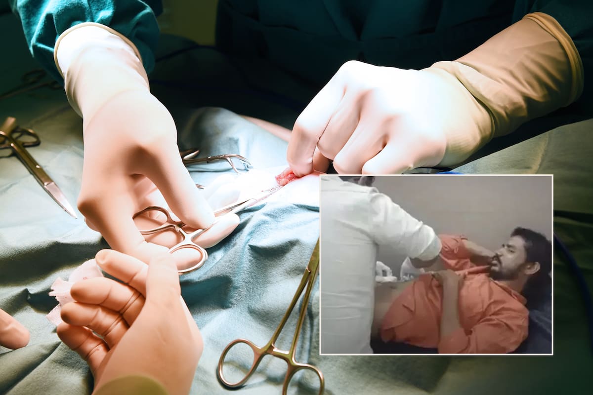 Hombre intenta operarse a sí mismo tras ver varios tutoriales en YouTube