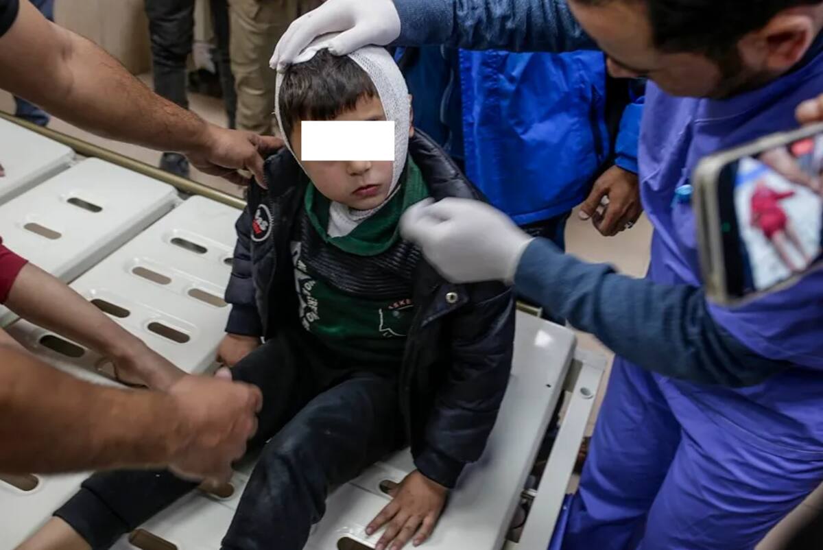 Un niño herido llega al hospital de los mártires de Al Aqsa tras un ataque aéreo israelí en el campo de refugiados de Al Bureij. / EFE-EPA-Mohammed Saber