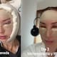 Mujer muestra su proceso de blefaroplastia y lifting, desde el quirófano hasta el postoperatorio, y causa impresión en redes sociales