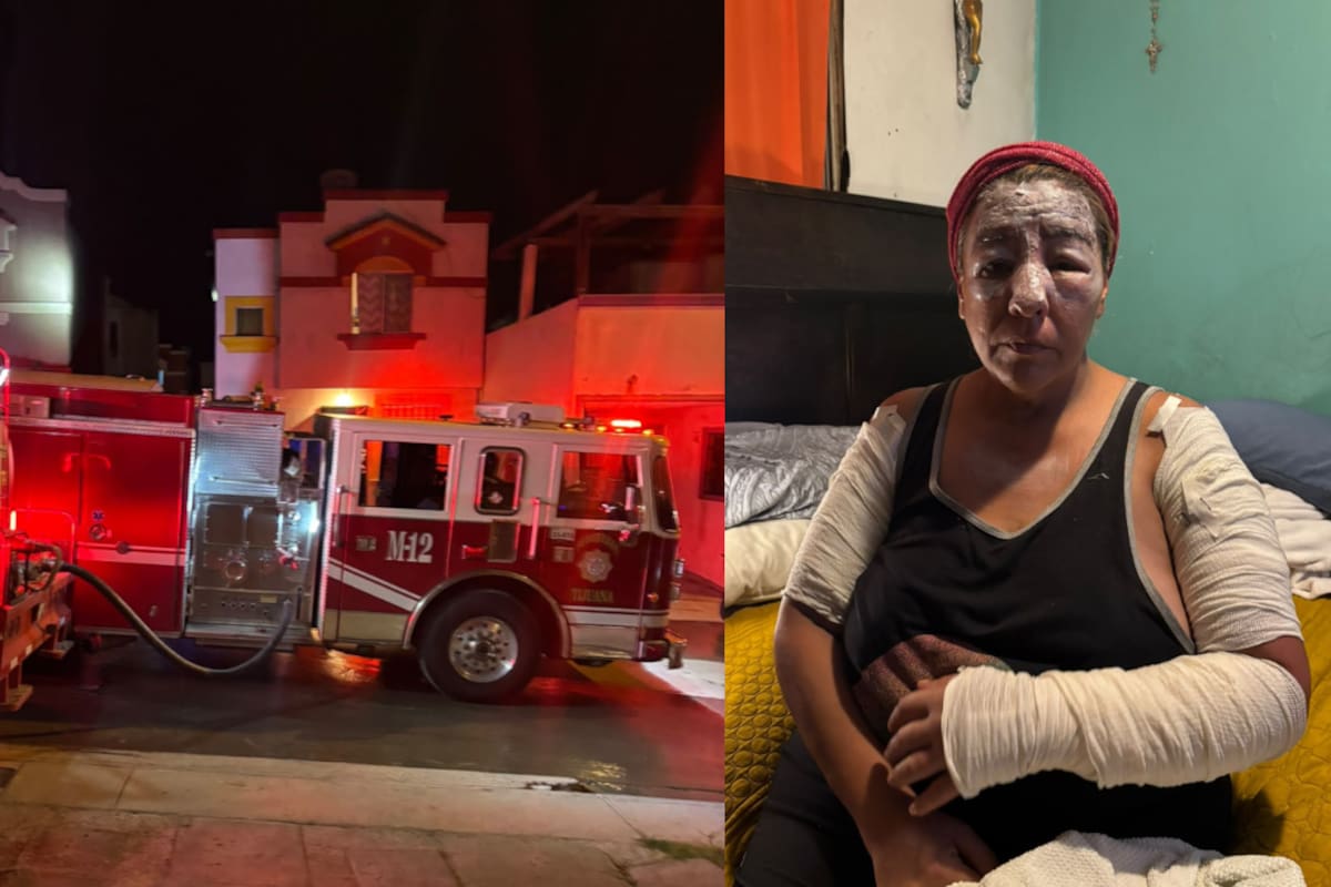 Rifa con causa busca ayudar a Karime tras incendio; hay hasta este martes para participar
