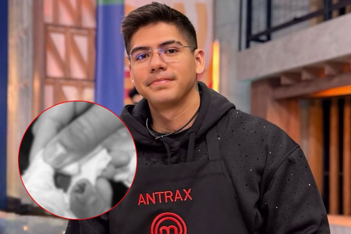 Así quedó la herida de Antrax tras ser atendido en una ambulancia durante el domingo de Eliminación de MasterChef 24/7 (FOTO)