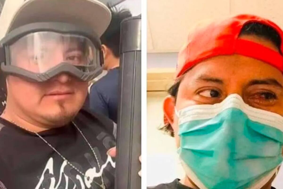 Influencer guatemalteco perderá un ojo por ver el eclipse