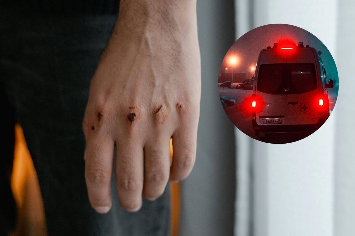 Golpean dos hombres a estudiante en Villa Bonita hasta dejarlo inconsciente