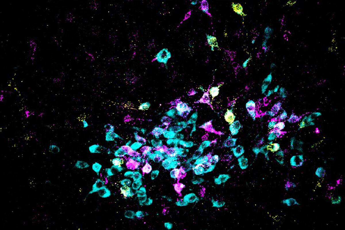 Encuentran cómo el estrés se convierte en miedo en el cerebro