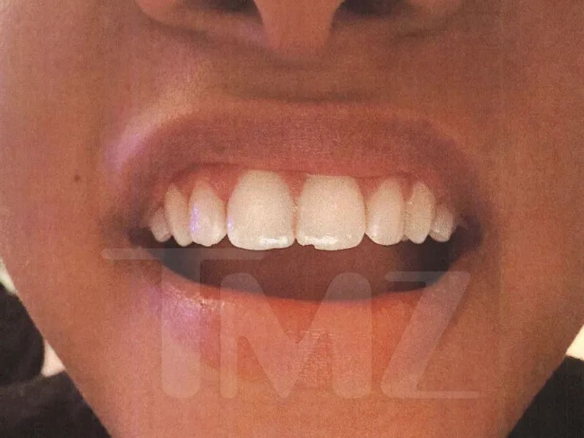Halle Bailey asegura que perdió parte de su diente tras brutal ataque de su ex pareja | Foto: TMZ.