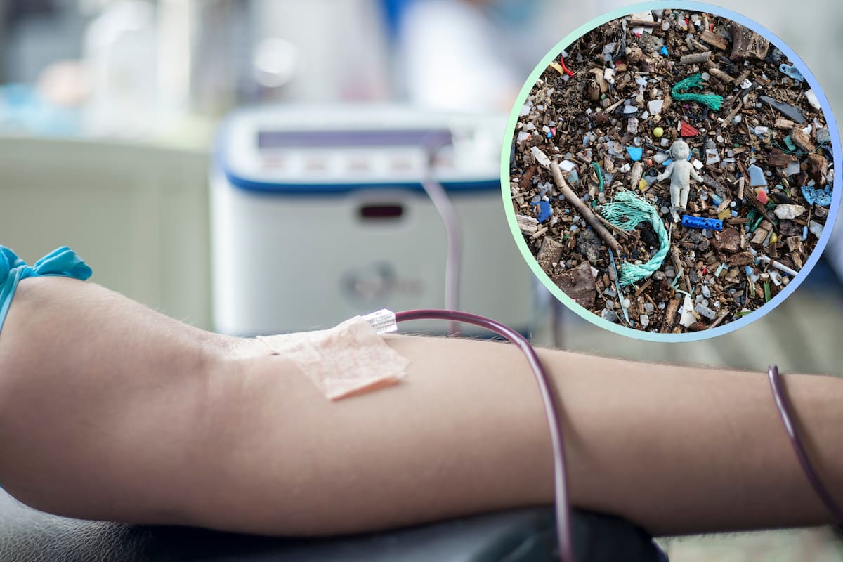 ¿Microplásticos en la sangre? Científicos exploran un tratamiento para eliminarlos del cuerpo