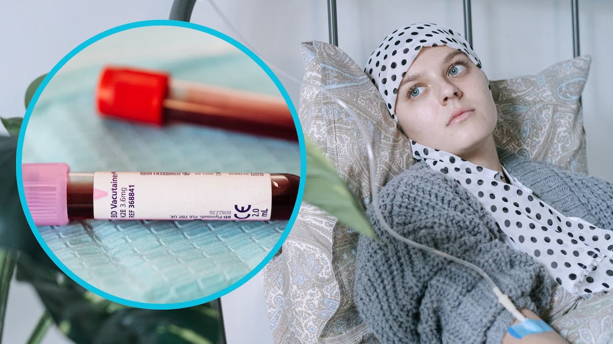 Las pruebas de sangre para detectar múltiples tipos de cáncer, como Galleri, generan interés por su promesa de identificar tumores de forma temprana/Foto: Canva