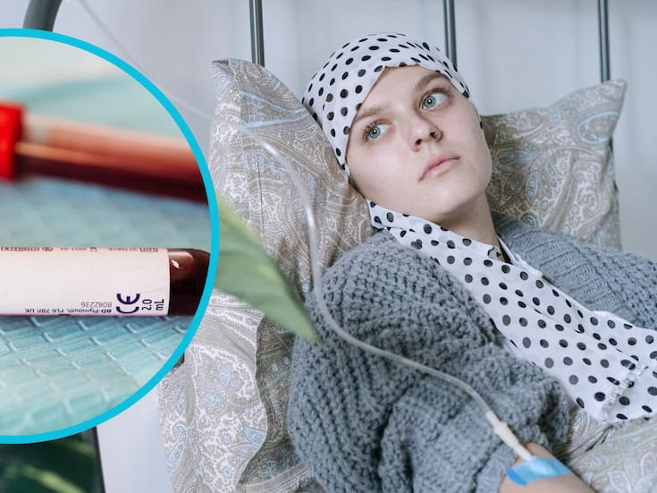 Pruebas de sangre para cáncer: esperanza, riesgos y lo que debe saber antes de usarlas