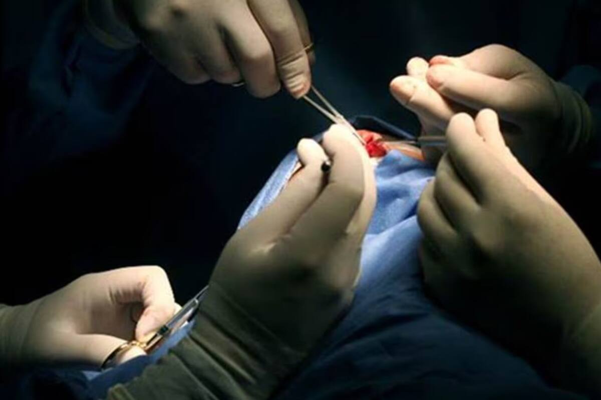 Muere paciente que recibió el primer trasplante de riñón de cerdo modificado genéticamente