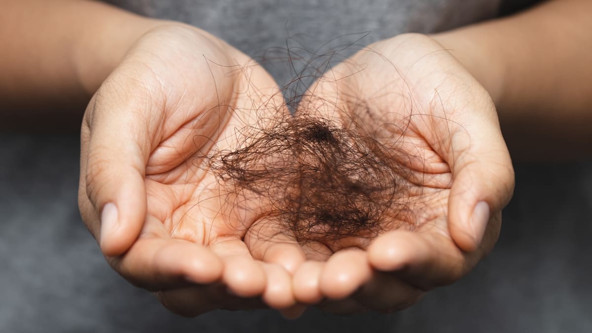 Cada vez más mujeres consultan por caída del cabello, pero muchas no saben cuándo deja de ser normal/Foto: Canva