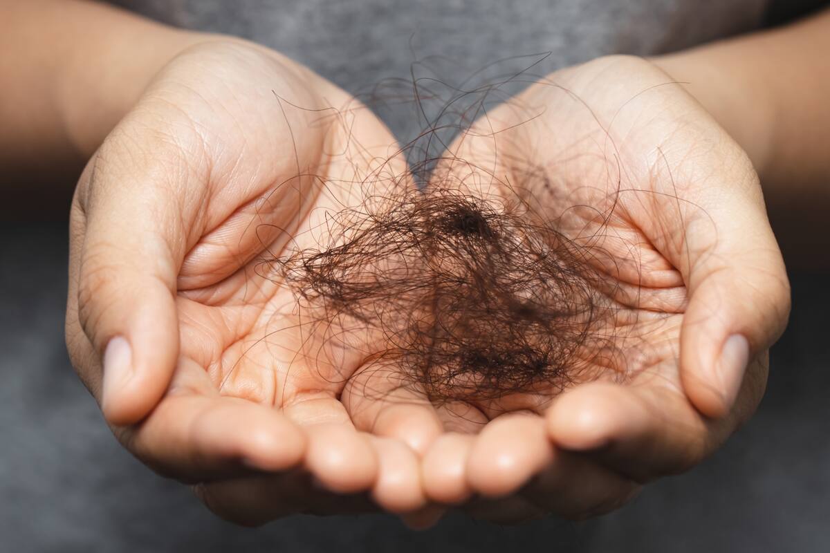 ¿Cuáles pueden ser las razones detrás de la caída de cabello en mujeres? ¿Cómo saber cuándo es normal y cuándo consultar?