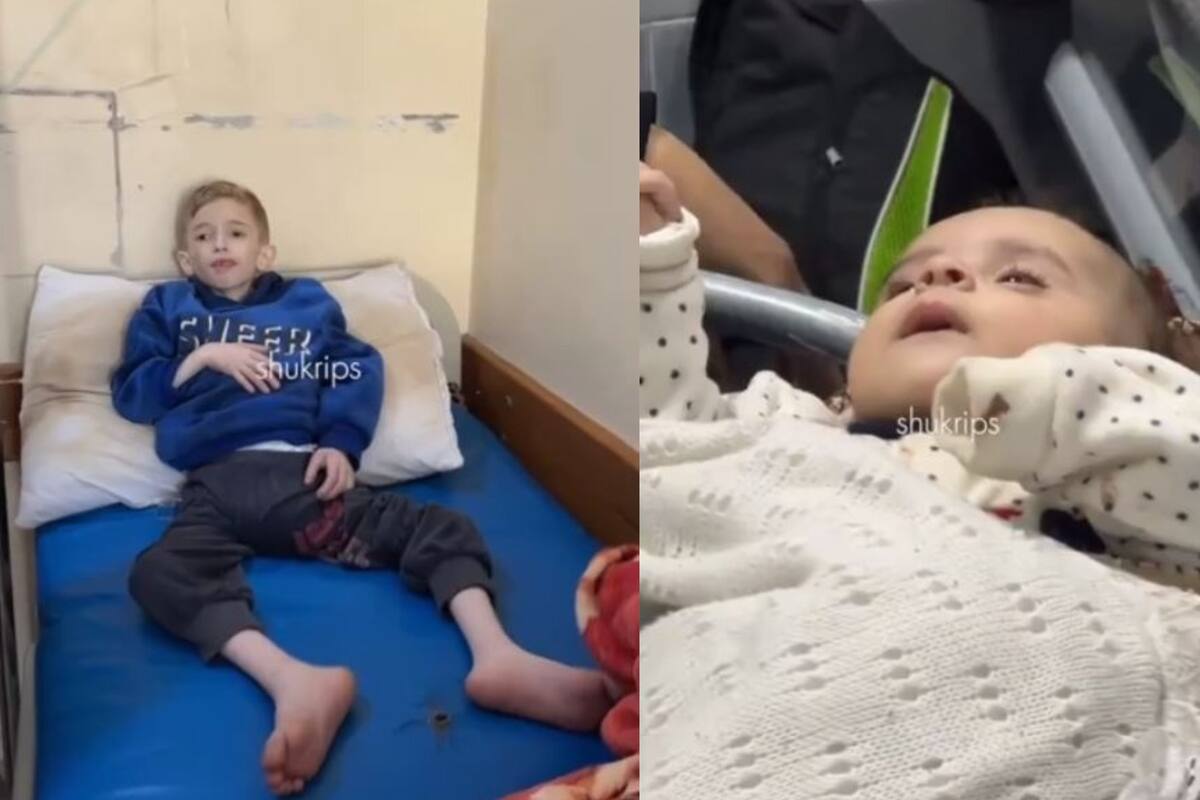 VIDEO: Niños muestran signos de desnutrición en hospital del norte de Gaza