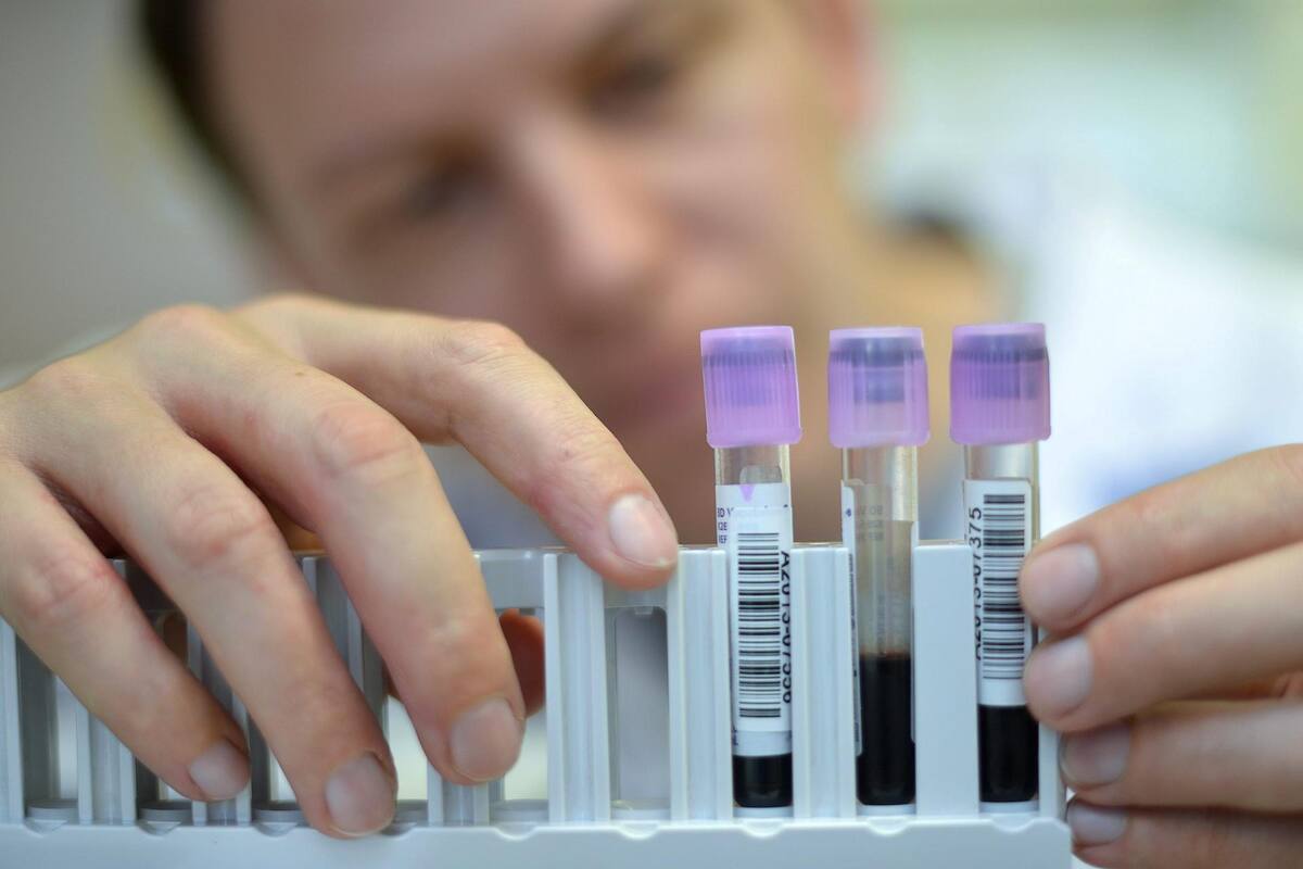 Análisis de sangre podría detectar el Parkinson 7 años antes de los síntomas